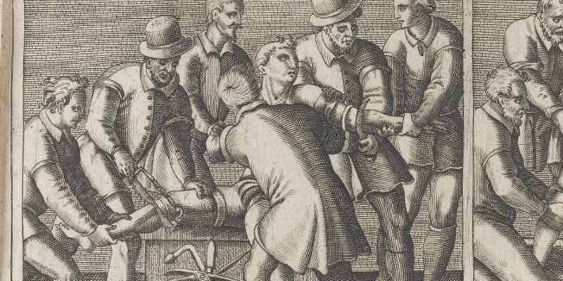 Ампутация без анестезии 19 век. Без анестезии. Без анестезии. Старые медицинские аппараты. Ампутация без анестезии 19 век.